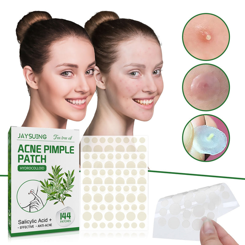 Acne Pimple Patches